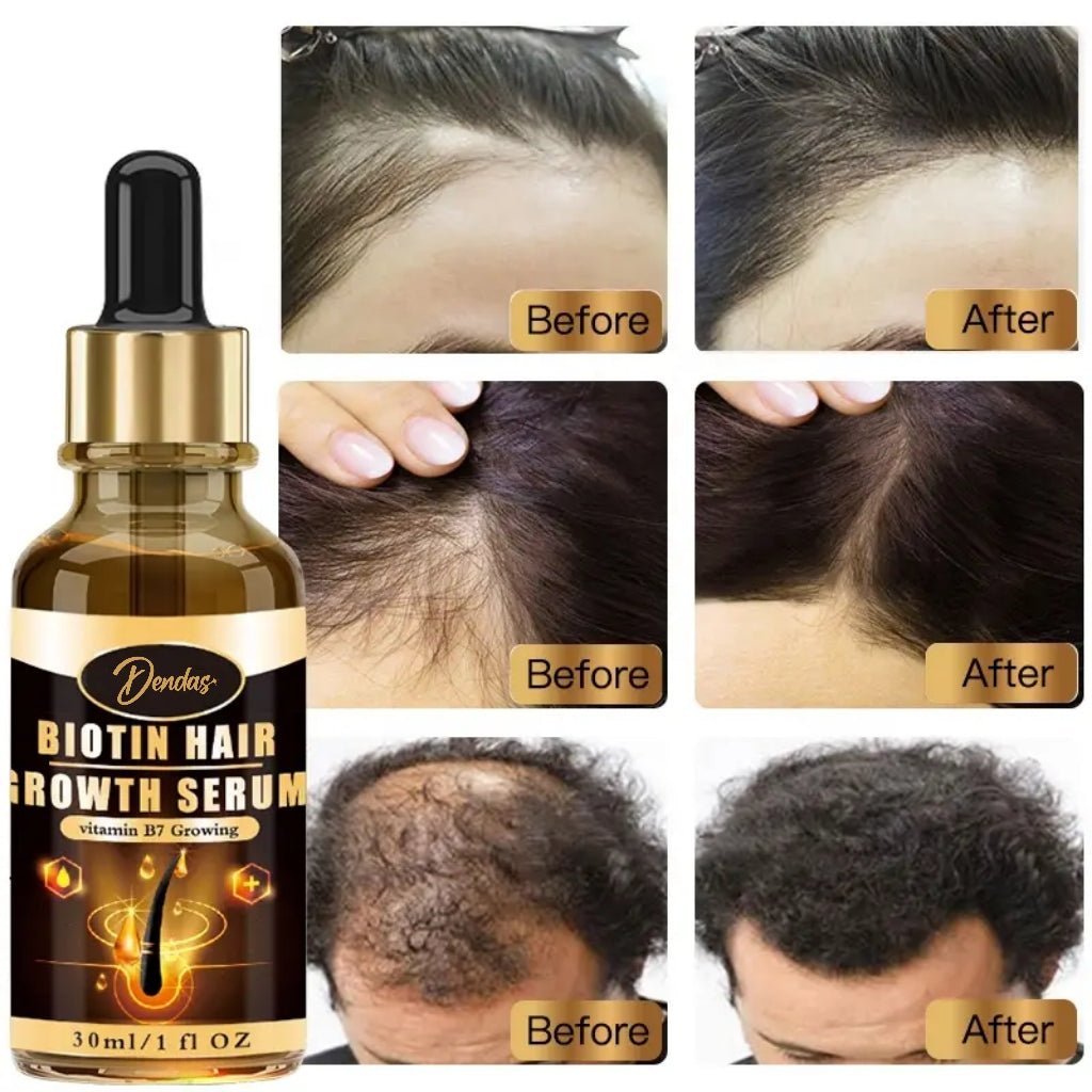 Biotin Hair Growth Serum - 1 fl oz (30ml) Unisex - DendasStore
