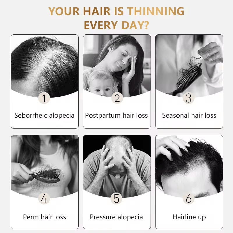Biotin Hair Growth Serum - 1 fl oz (30ml) Unisex - DendasStore