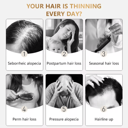 Biotin Hair Growth Serum - 1 fl oz (30ml) Unisex - DendasStore